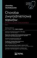 Okadka - Choroba zwyrodnieniowa staww. Wspczesne spojrzenie