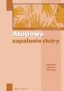 Ok�adka - Atopowe zapalenie sk�ry. Poradnik lekarza praktyka
