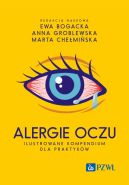 Okadka - Alergie oczu. Ilustrowane kompendium dla praktykw