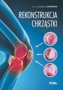 Ok�adka - Rekonstrukcja chrz�stki. Ratujemy kolano, nie wymieniamy