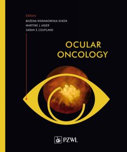 Okadka ksiki - Ocular Oncology