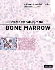 Okadka ksiki - Illustrated Pathology of the Bone Marrow
